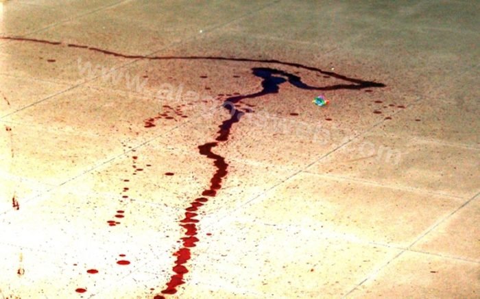 Garoto de 5 anos tem órgão genital decepado pelo padrasto em CE