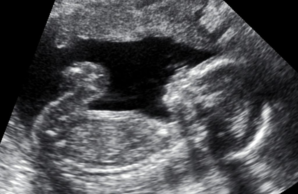 Justiça alagoana autoriza mulher a interromper gravidez 1 Ilustração