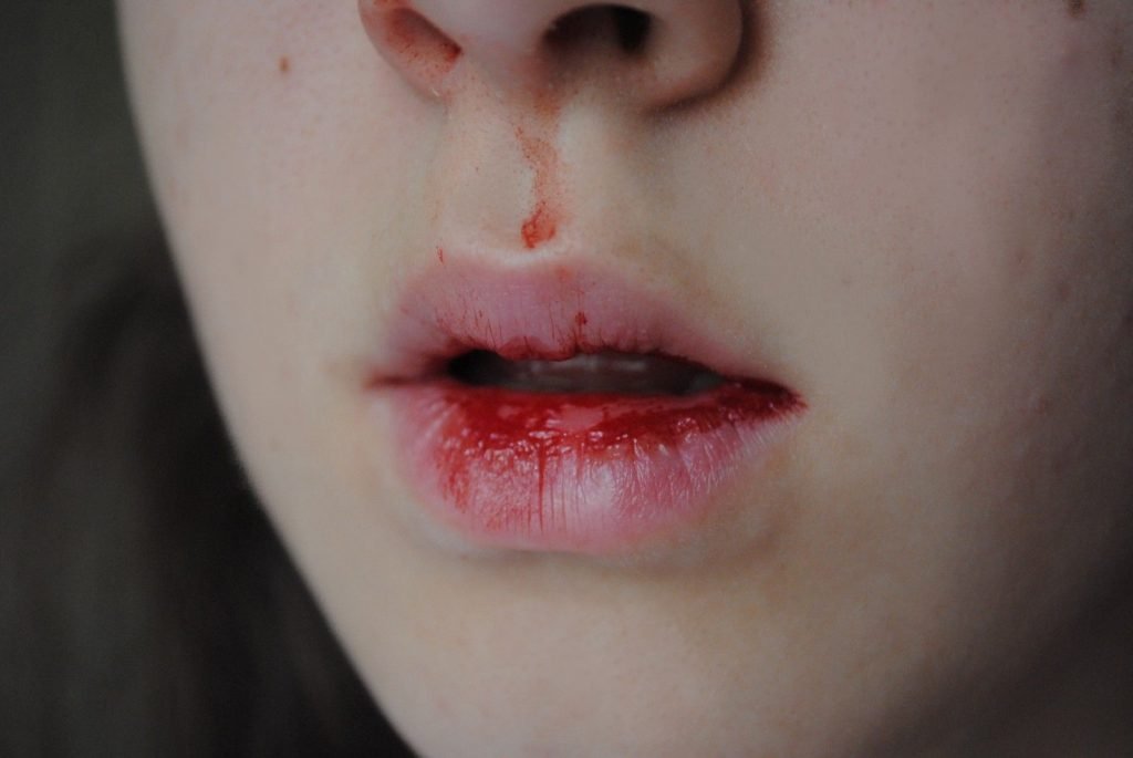 Gosto de sangue - Principais causas para sentir o sabor na boca 1 Wallhere