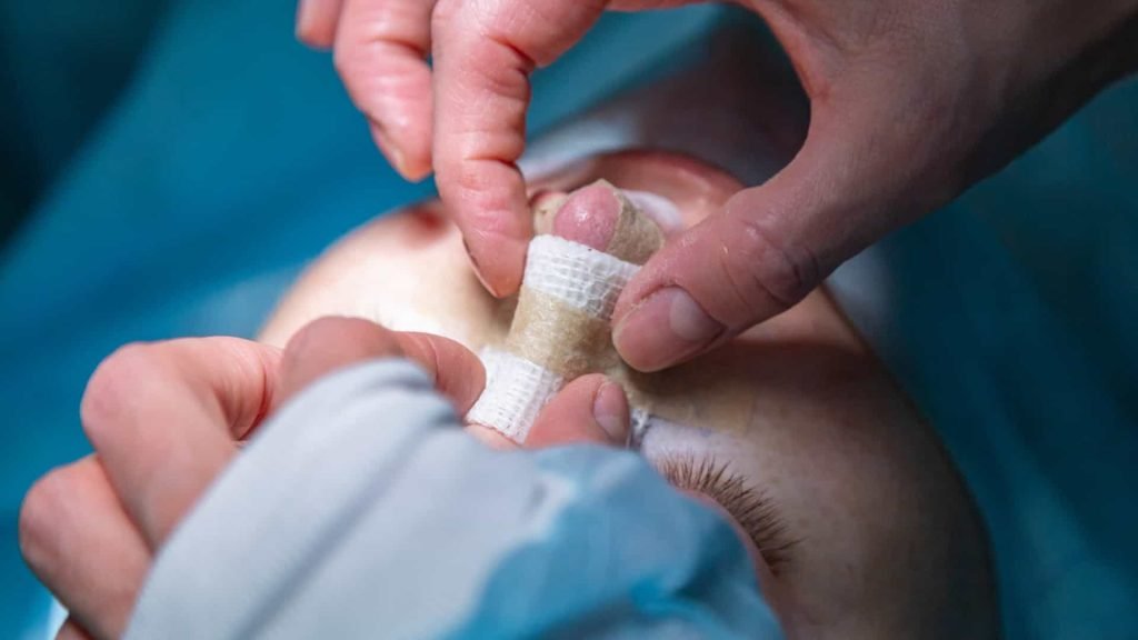 Homem é hospitalizado após tentar a viral 'rinoplastia caseira' 1 Shutterstock