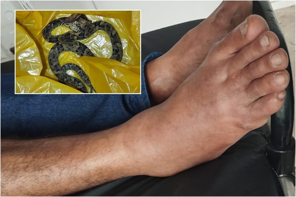 Homem é socorrido às pressas após ser picado por cobra em São Miguel dos Campos