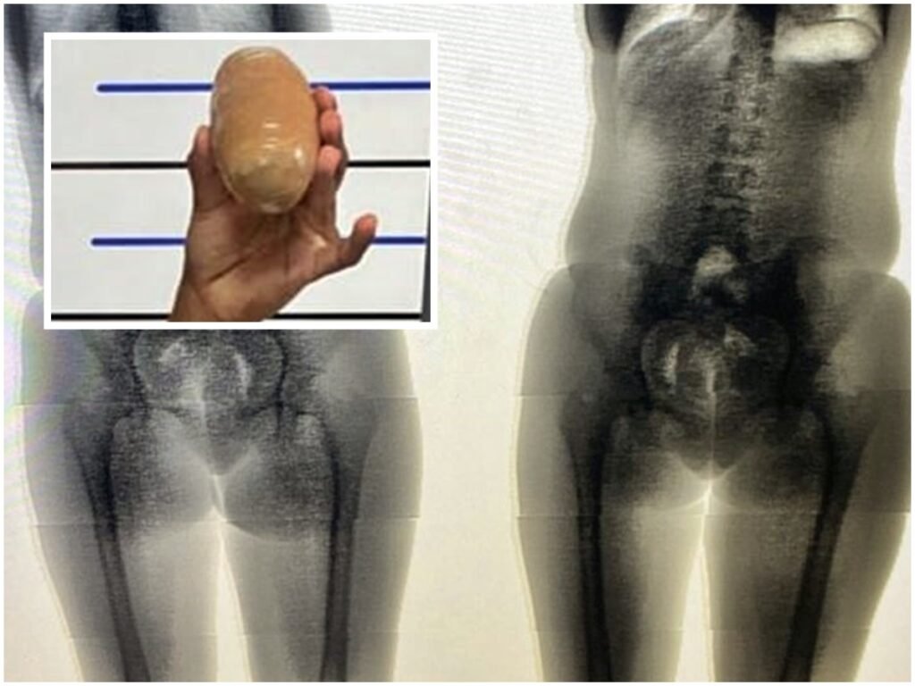 droga escondida na vagina em presídio