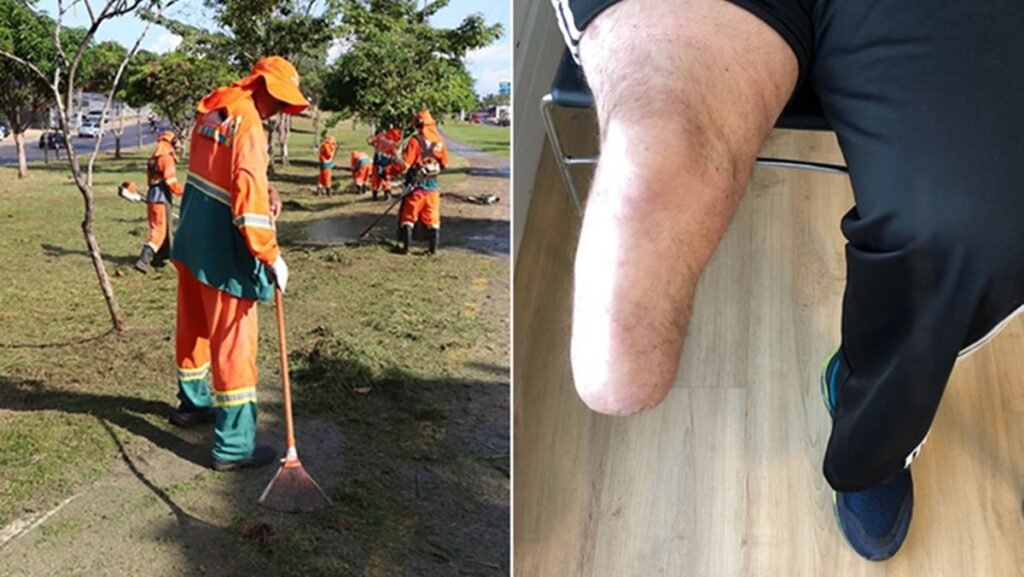 Homem sem pé condenado a capinar praça