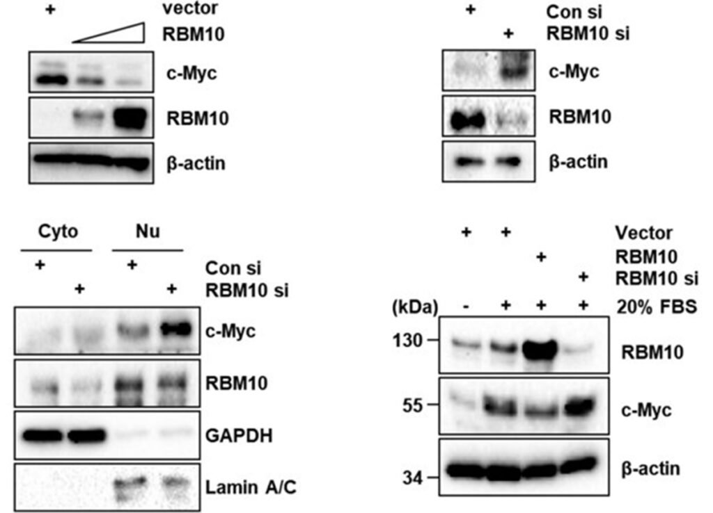 Descoberta forma de inibir proteína mutante que causa câncer de pulmão