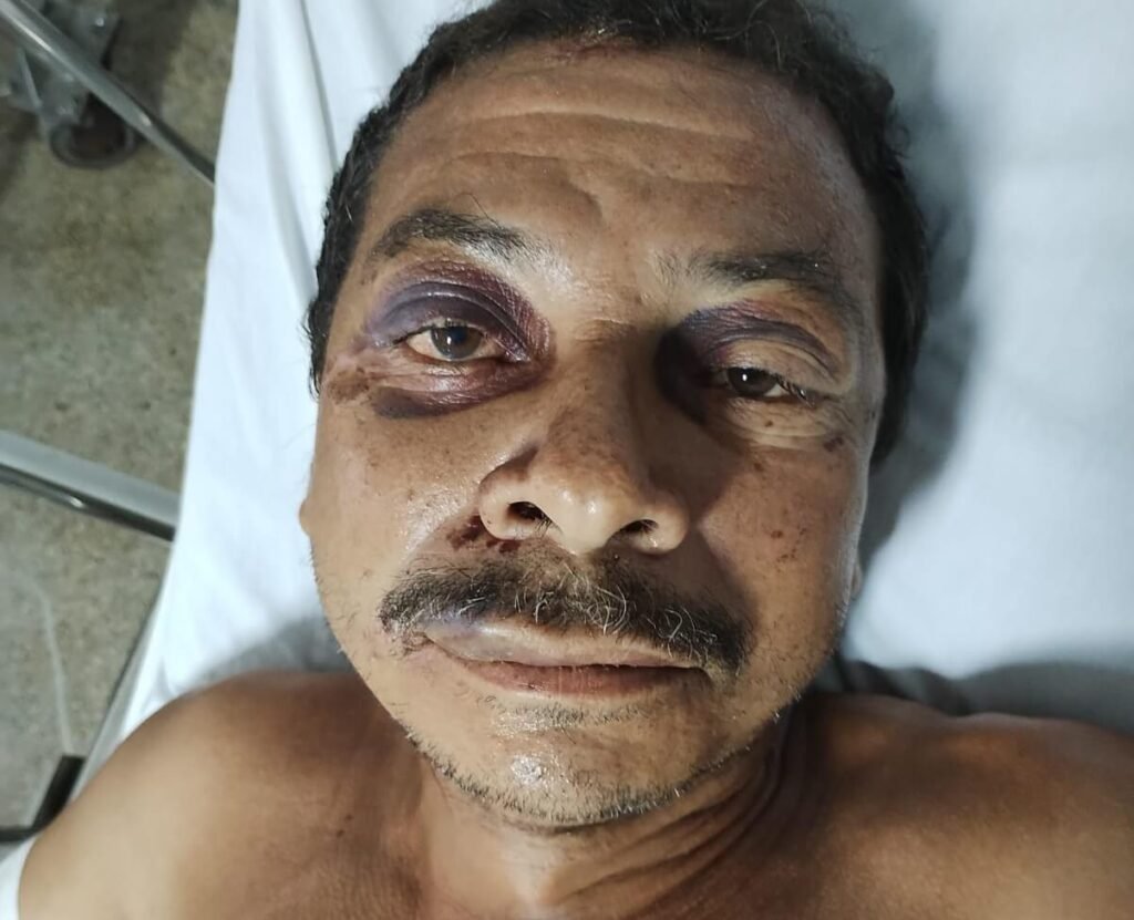 HGE procura familia de paciente