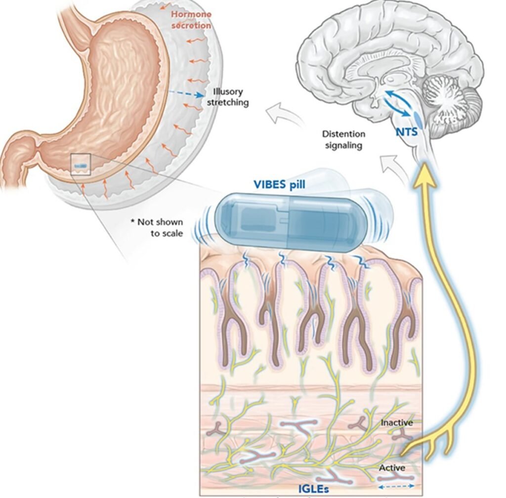 Pílula eletrônica cria ilusão de saciedade para combater obesidade