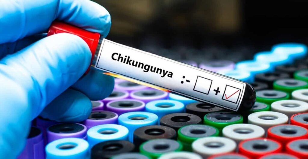 Estudo mostra o que faz a chikungunya ser tão fatal