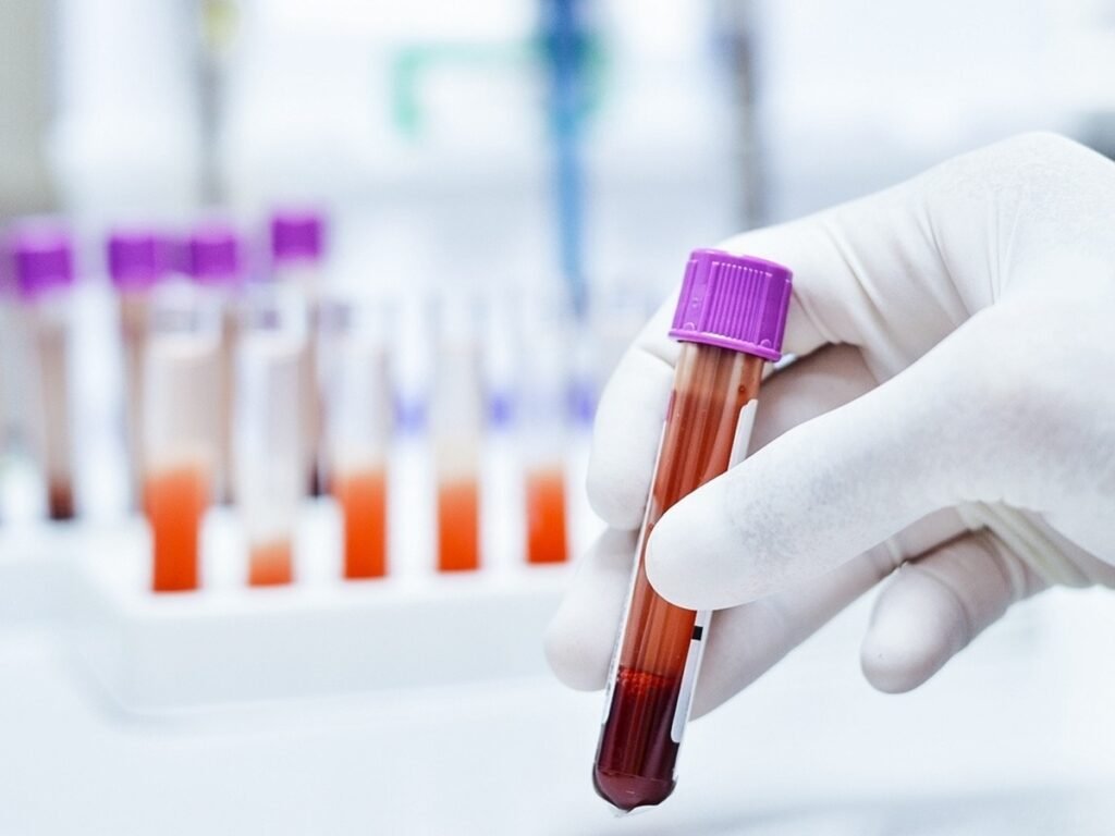 Pesquisadores descobrem um novo tipo sanguíneo