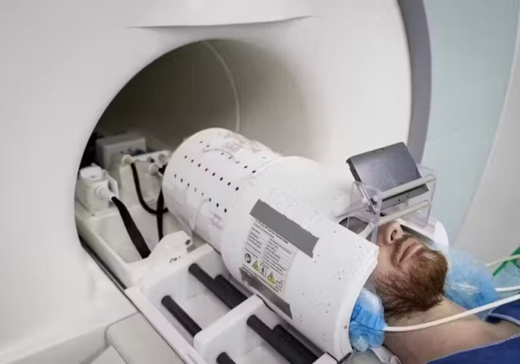 Máquina poderosa de ressonância mostra cérebro com 10 vezes mais precisão