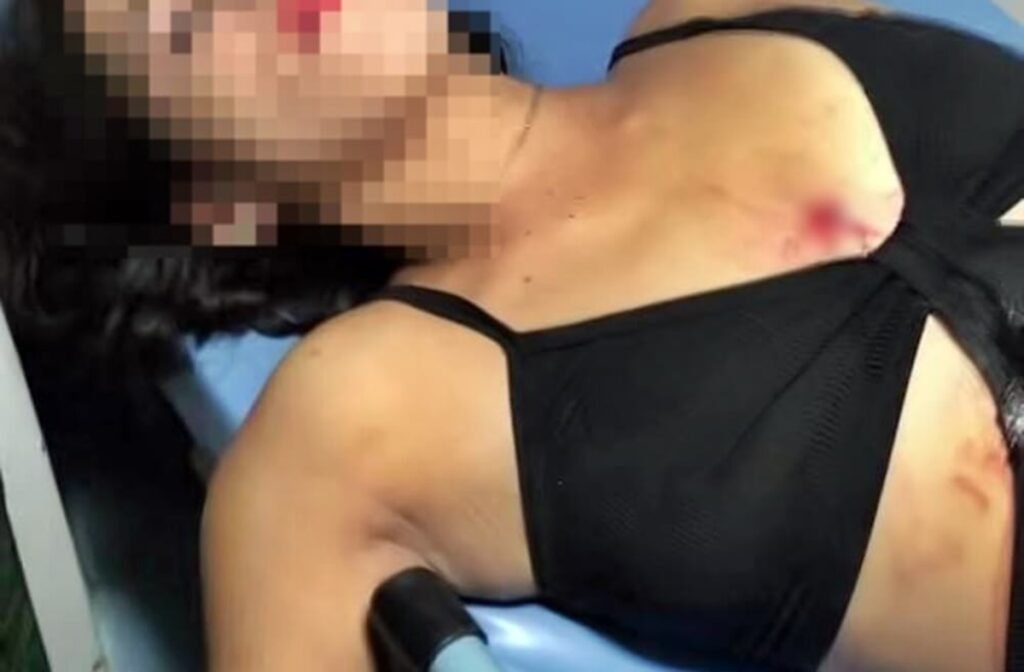 PCAL prende homem que tentou matar companheira grávida em Craíbas