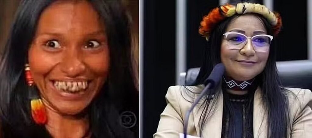 Deputada tem mandato cassado após pagar tratamento estético com dinheiro público