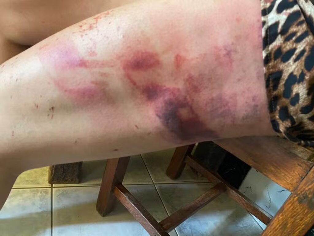 Influencer é atacada com facão pelo pai após discussão por dinheiro