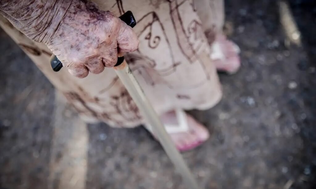 Ortopedistas alertam para risco de queda de idosos