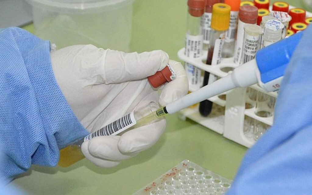 Febre Oropouche avança em Alagoas com 19 casos confirmados