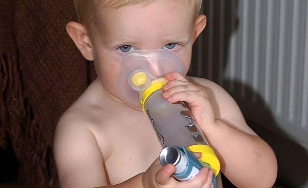 O que é asma e quais os sintomas em crianças