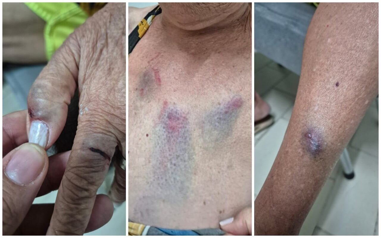 Médica é presa duas vezes em flagrante por agredir idosa de 77 anos em Arapiraca